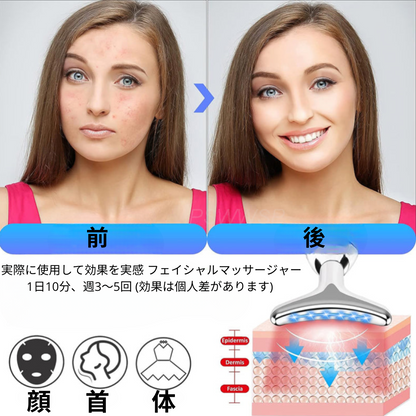 フェイシャルマッサージャー™